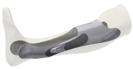 個性化加固設(shè)計的軟件工具 行業(yè)新聞 第3張 個性化加固設(shè)計的軟件工具 行業(yè)新聞 第3張