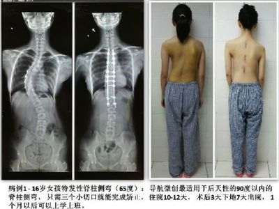 加固效果評估的實際案例 行業(yè)新聞 第4張 加固效果評估的實際案例 行業(yè)新聞 第4張