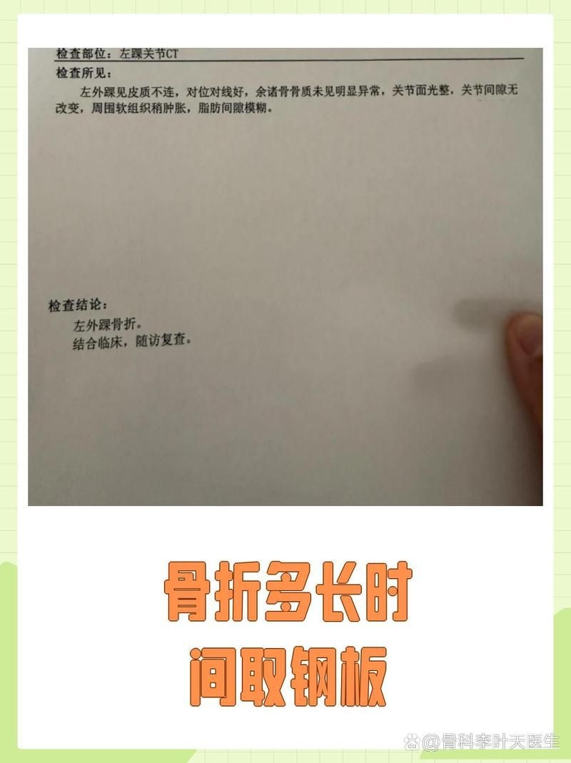 術(shù)后多久可以取鋼板？（取鋼板后多久能恢復(fù)正常活動(dòng),取鋼板前后注意事項(xiàng)清單） 行業(yè)新聞 第1張