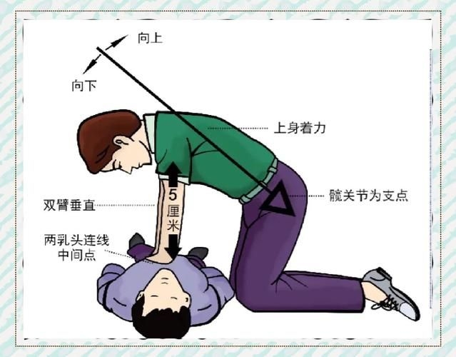 哪種方法適合緊急情況（醫(yī)療急救（cpr/aed/aed）） 行業(yè)新聞 第4張